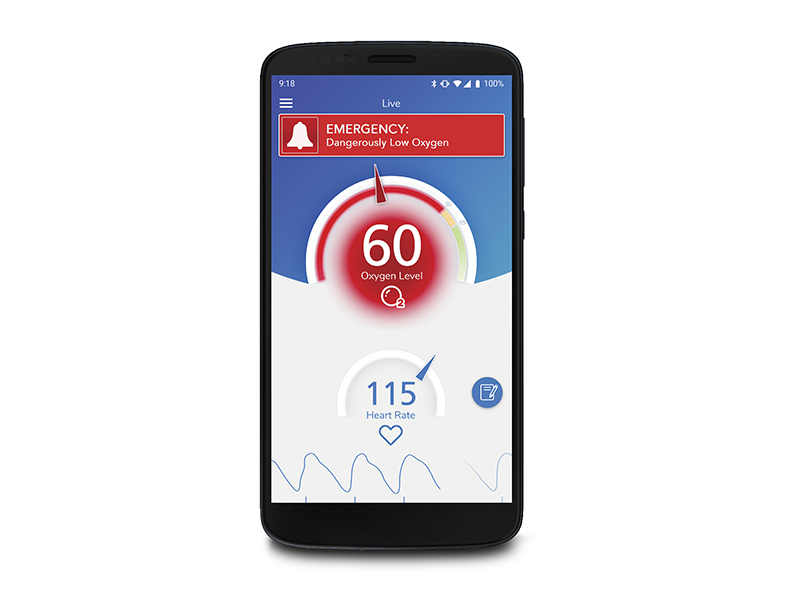 Phone displaying Masimo SafetyNet Alert App Emergency Screen